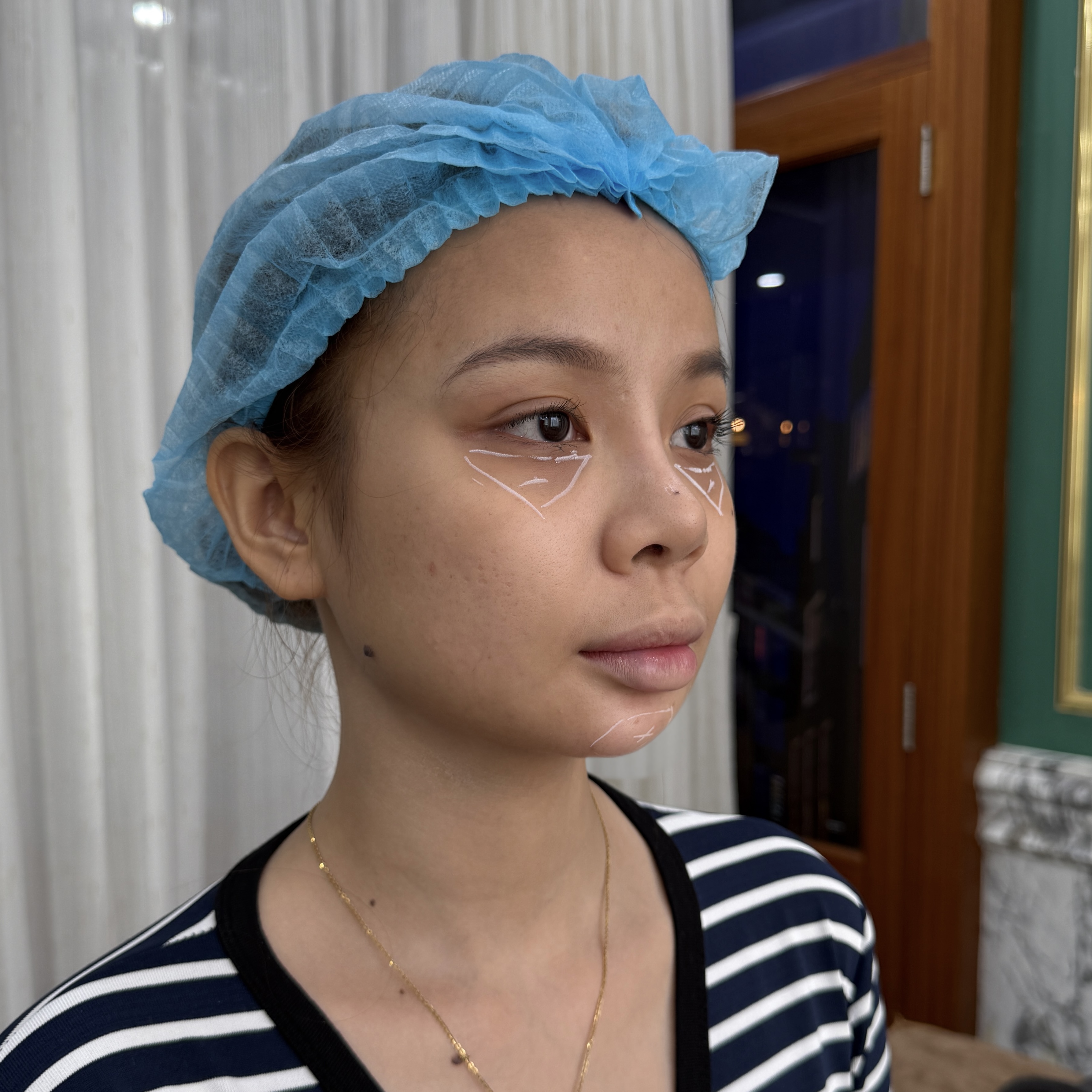 Trước